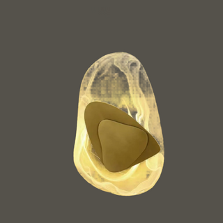 Orelux  | LED-Wandlampe | Energieeffizient